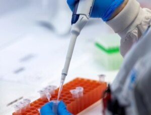 Türkiye’de maymun çiçeği olayı var mı?